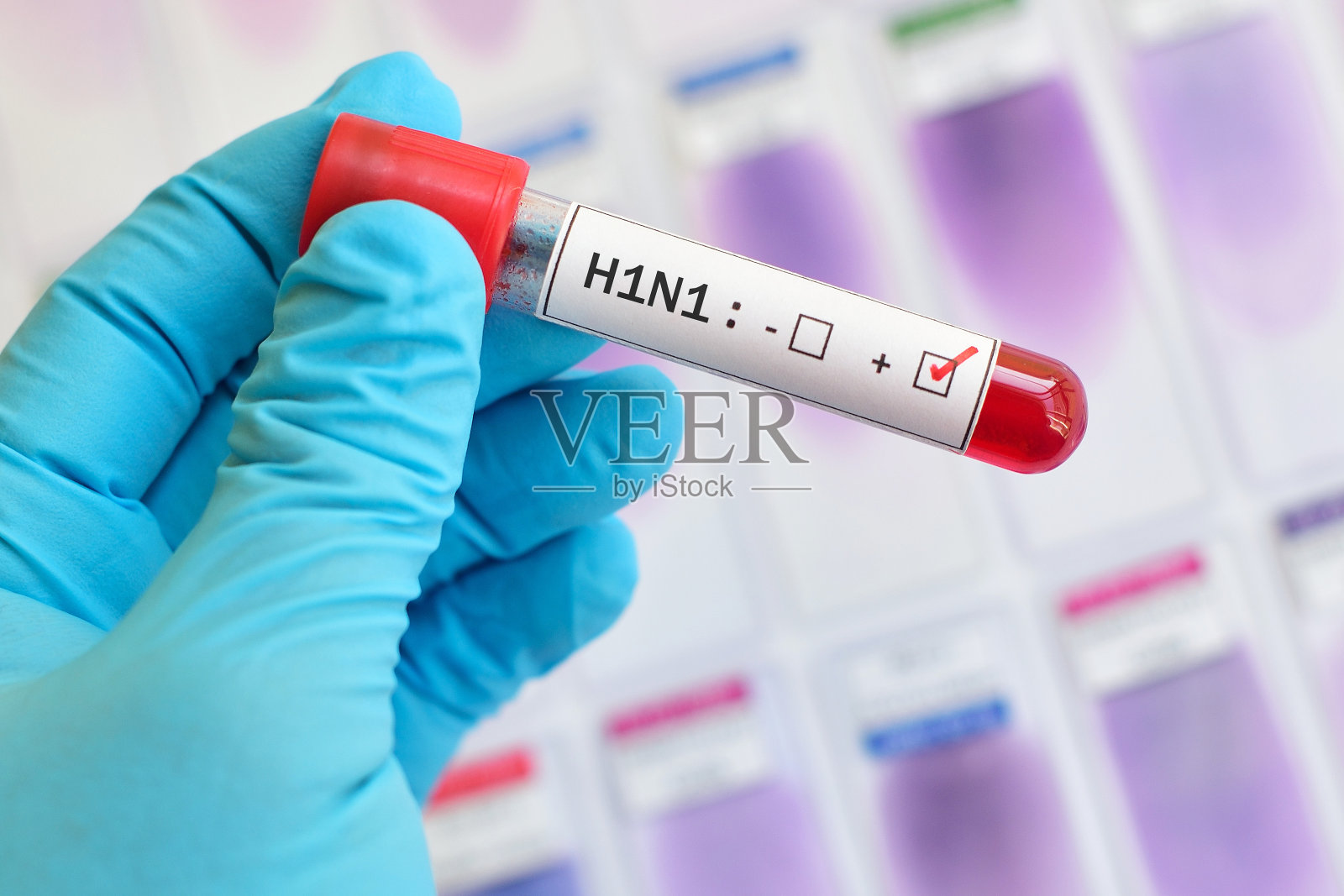 H1N1流感病毒阳性照片摄影图片