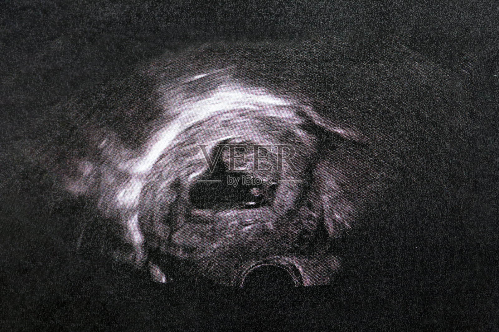 母亲子宫内婴儿的超声波图。照片摄影图片