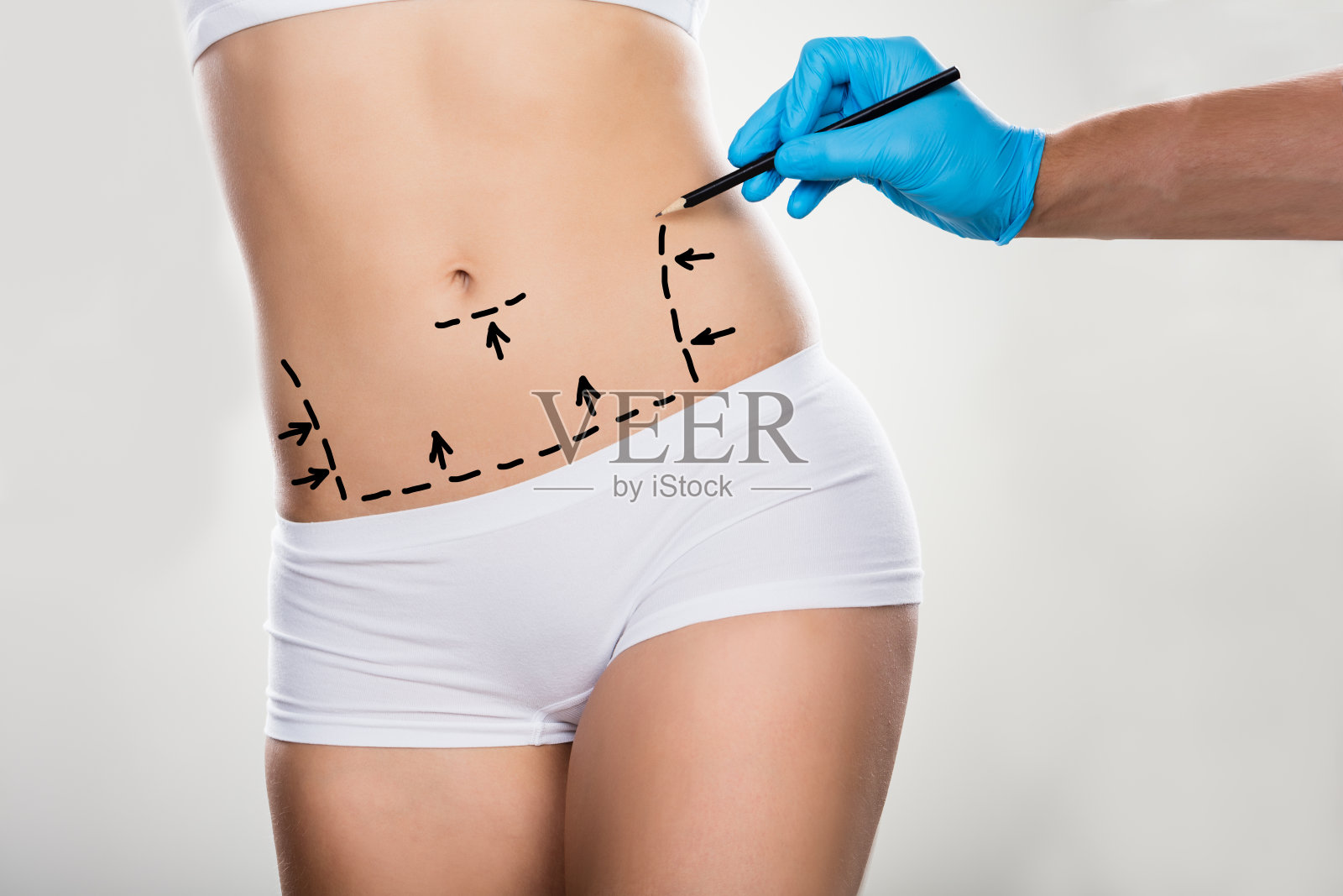 外科医生在妇女的腹部画矫正线照片摄影图片