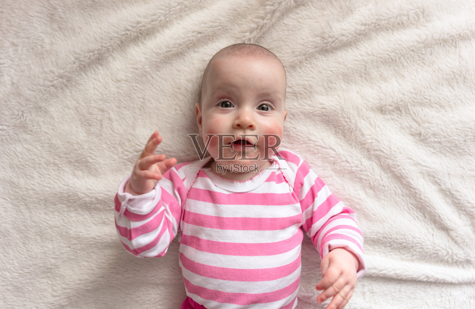 婴儿的皮疹概念照片摄影图片