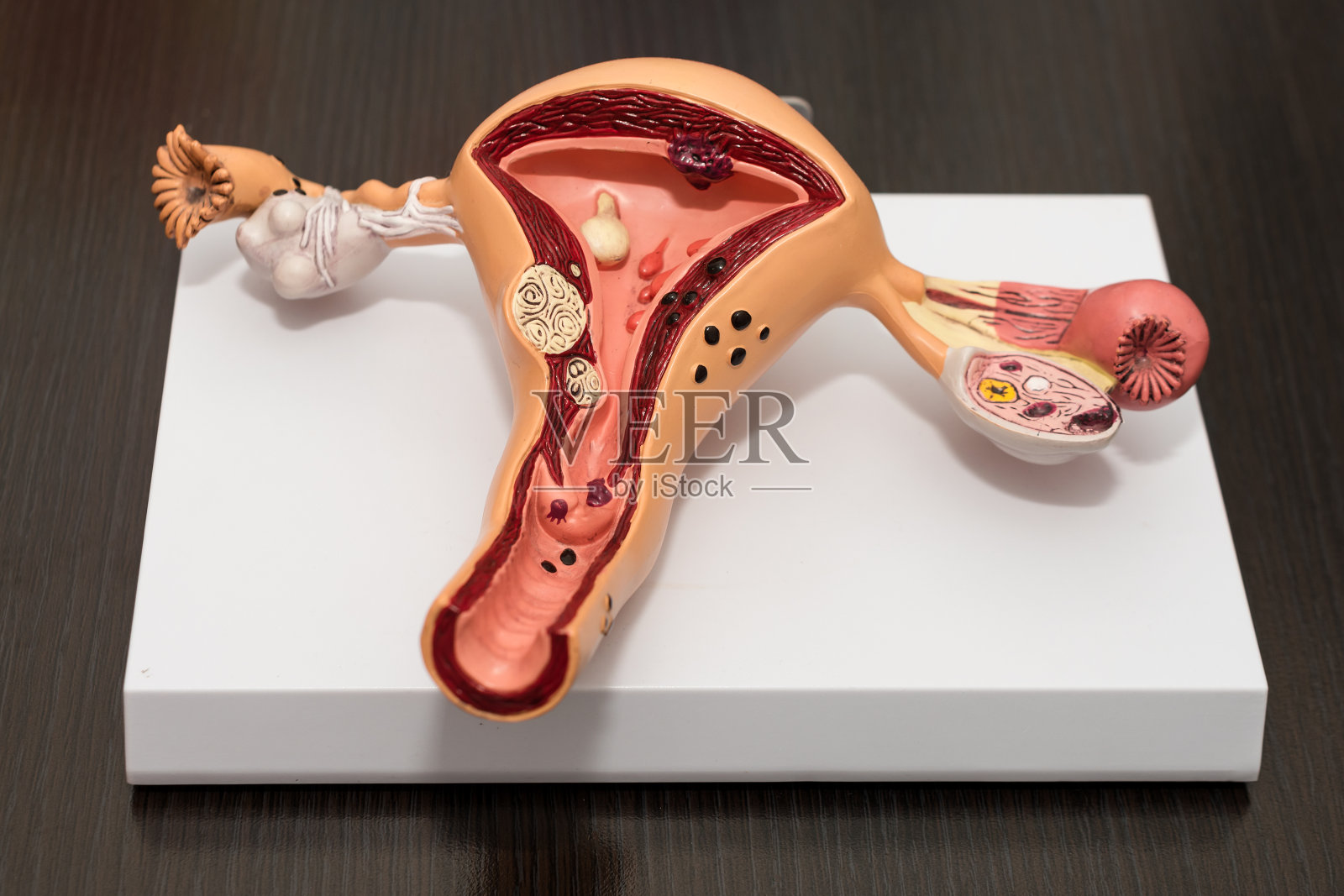 女性生殖系统的典范。子宫带卵巢的解剖模型。健康女性生殖系统的概念。照片摄影图片