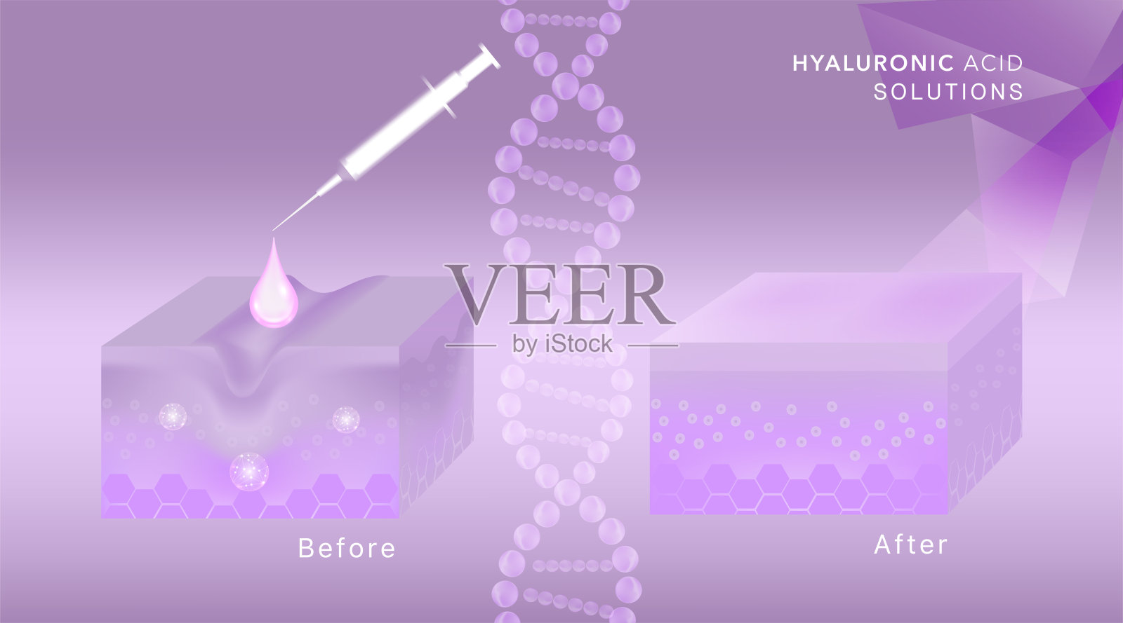 透明质酸广告护肤液前后，紫色胶原蛋白血清滴液配合化妆品广告背景即可使用。设计模板素材