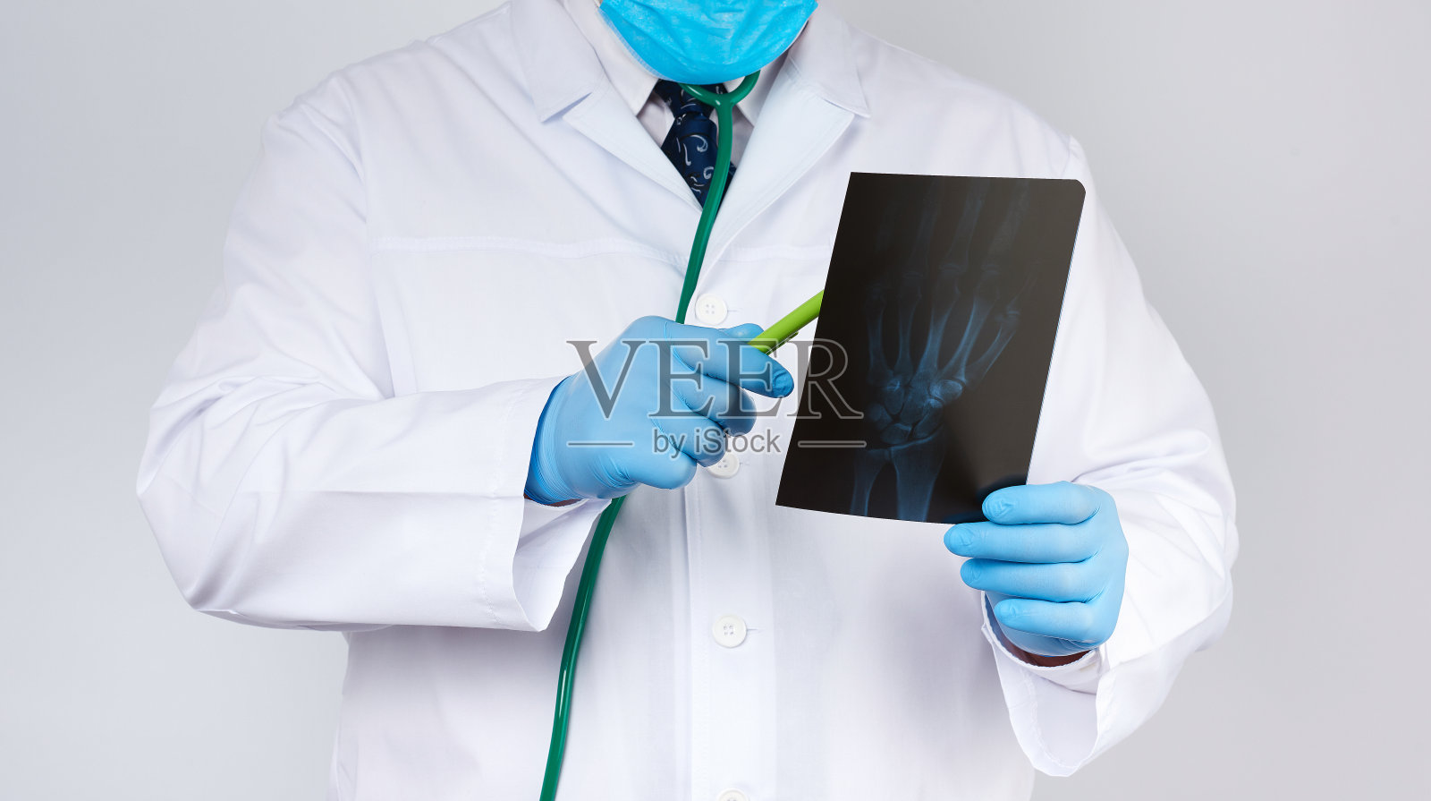 一名身穿白大褂，戴着蓝色乳胶手套的医生拿着一张男子手部的x光片照片摄影图片