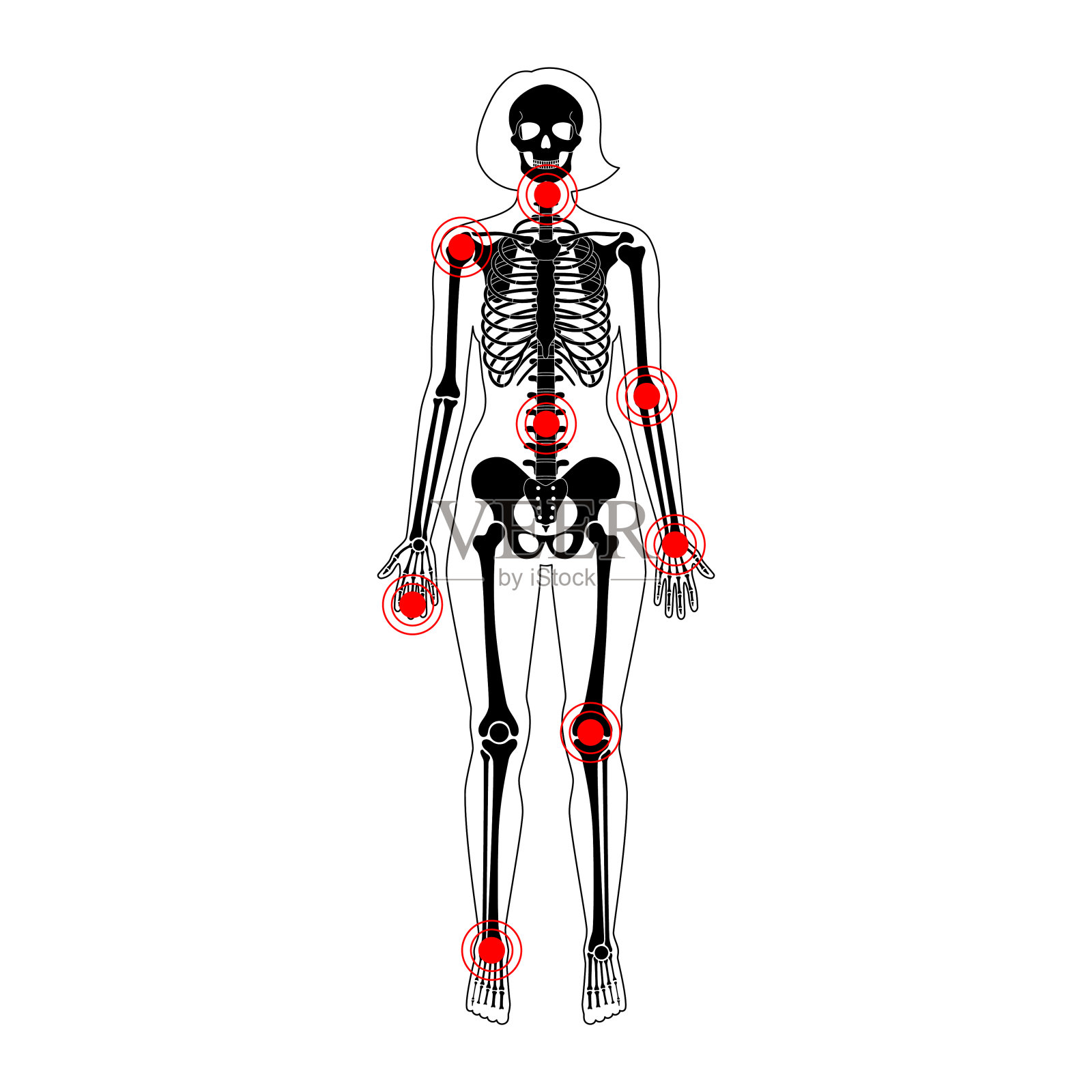人体骨骼关节疼痛插画图片素材