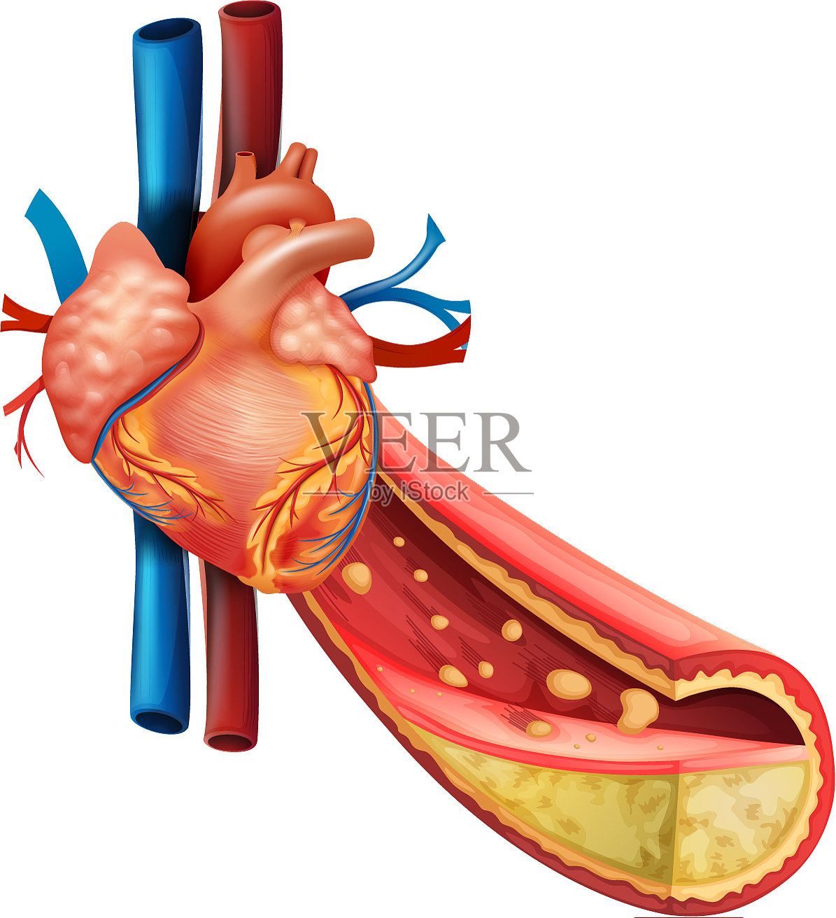 图显示人类心脏和脂肪静脉插画图片素材
