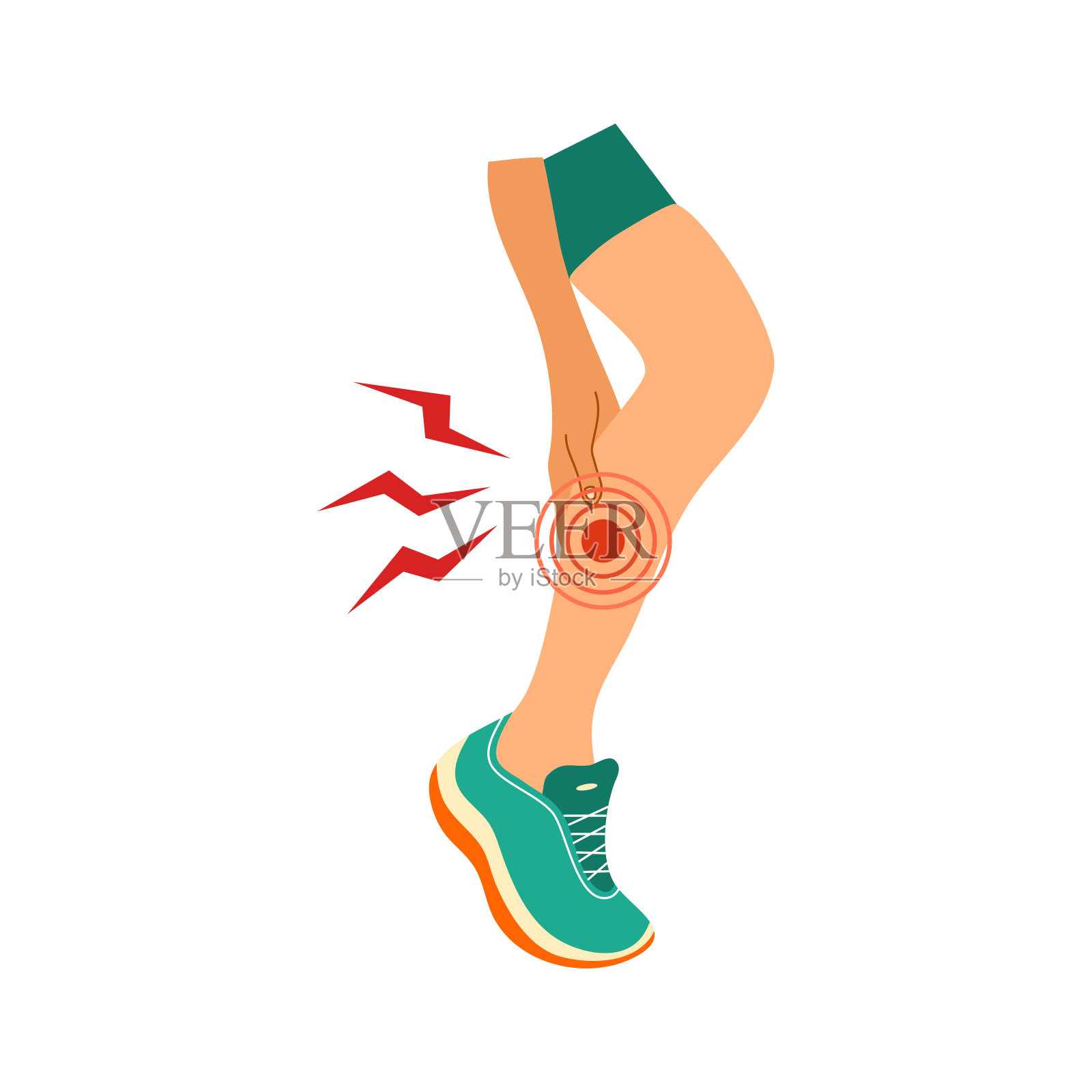 腿部疼痛或运动创伤概念。女运动员感到腿受伤。有关节或肌肉酸痛和疼痛问题的女性运动员。伤害事故。平面向量插图插画图片素材_ID ...