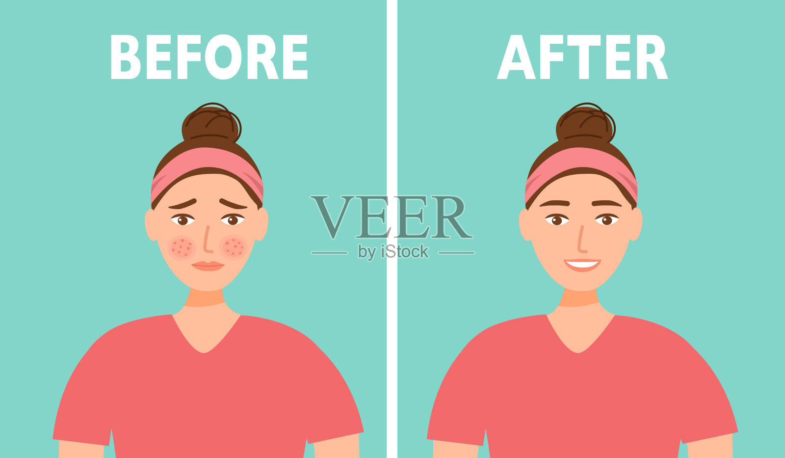 女性面部痤疮前后皮肤护理治疗在平面设计。插画图片素材