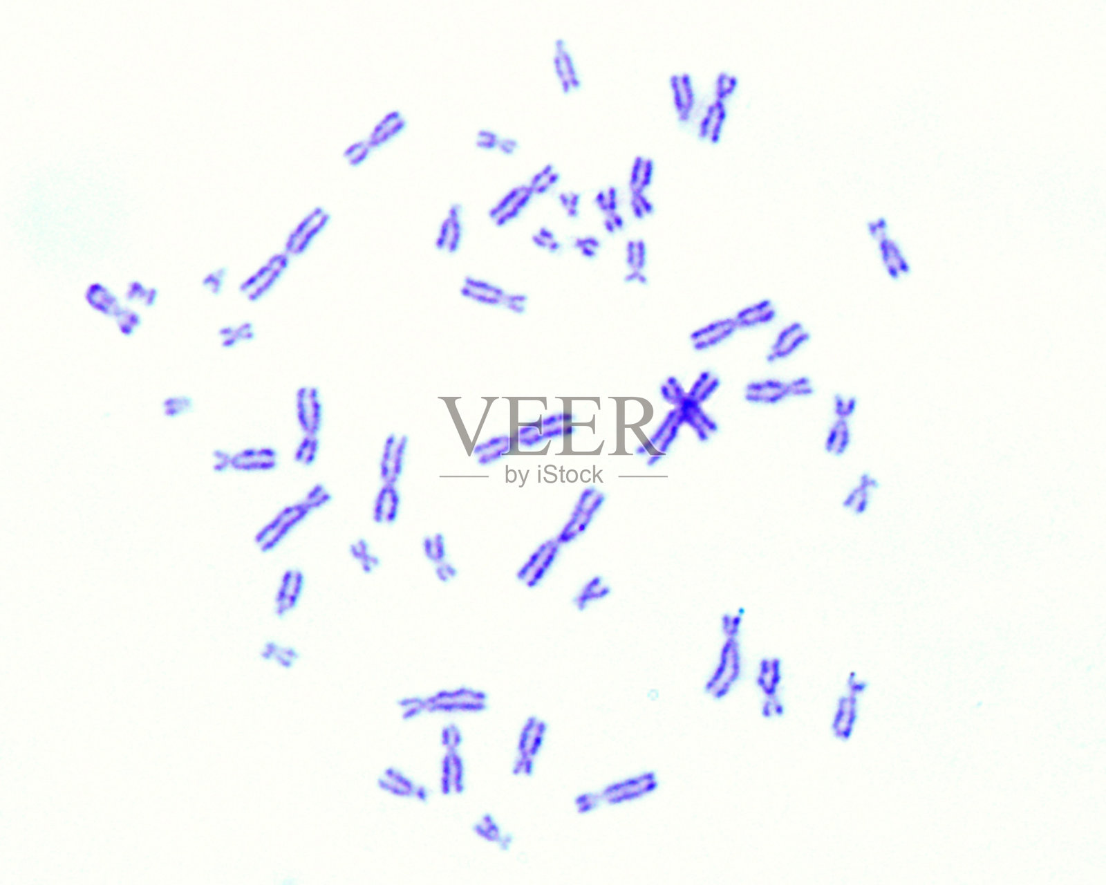 人类染色体组型照片摄影图片