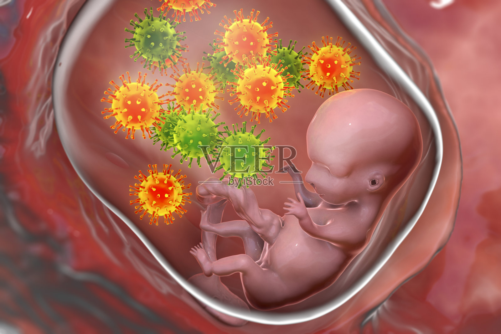 胎盘前置胎盘妊娠期间子宫内的胎儿插画图片素材_ID:428099383-Veer图库