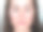 丘疹脓疱性酒渣鼻，病人脸部特写-长期戴口罩的后果素材图片